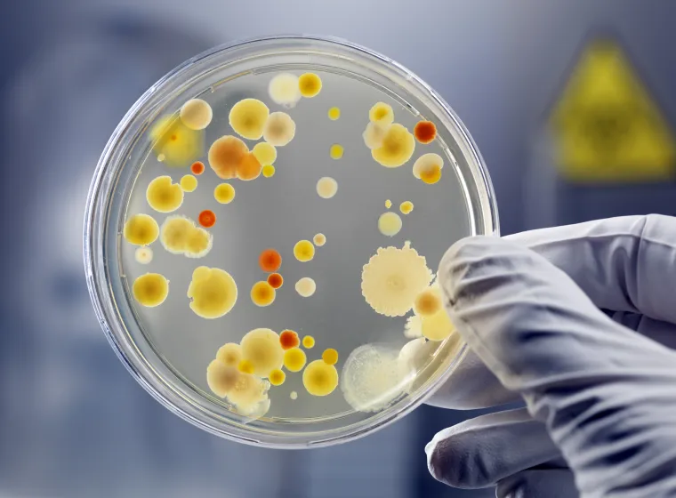 Clean culture of aerobic bacteria on agar plate, biohazard sign in background. Selective focus on petri dish, slightly blue toned, AdobeRGB color profile. Content of my lightbox medical &amp; sciences: