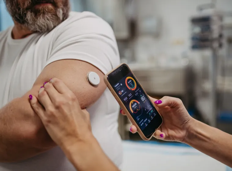 Doctor connecting patient's continuous glucose monitor with smartphone, to check his blood sugar level in real time. Obese, overweight man is at risk of developing type 2 diabetes. Concept of health risks of overwight and obesity.