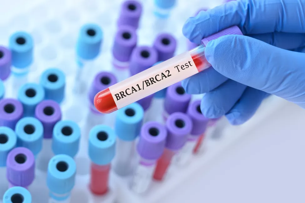 Doctor holding a test blood sample tube