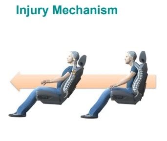 Injury Mechanism