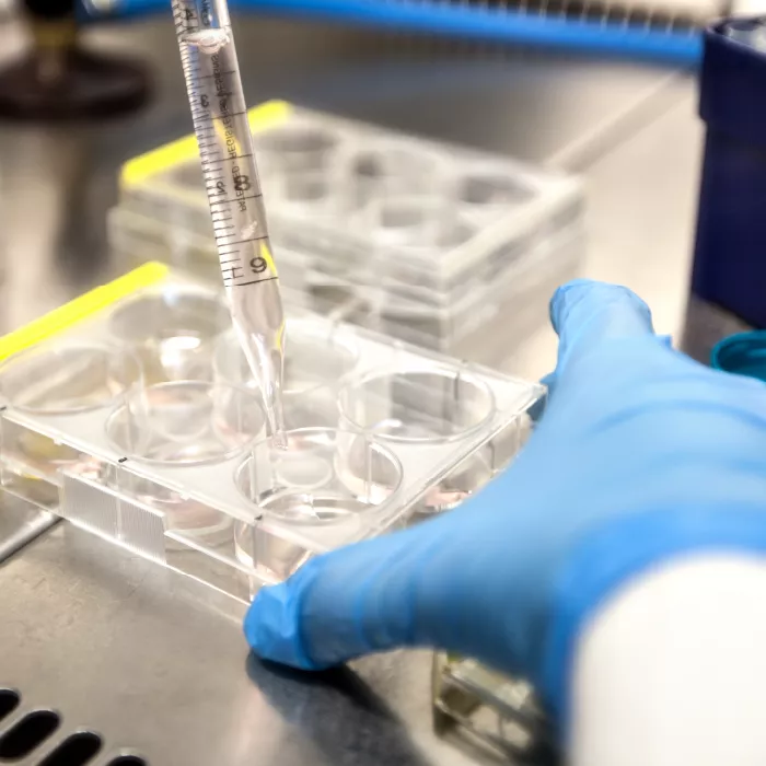 A scientist wearing a blue glove adds clear solution from a dropper to a tray of samples