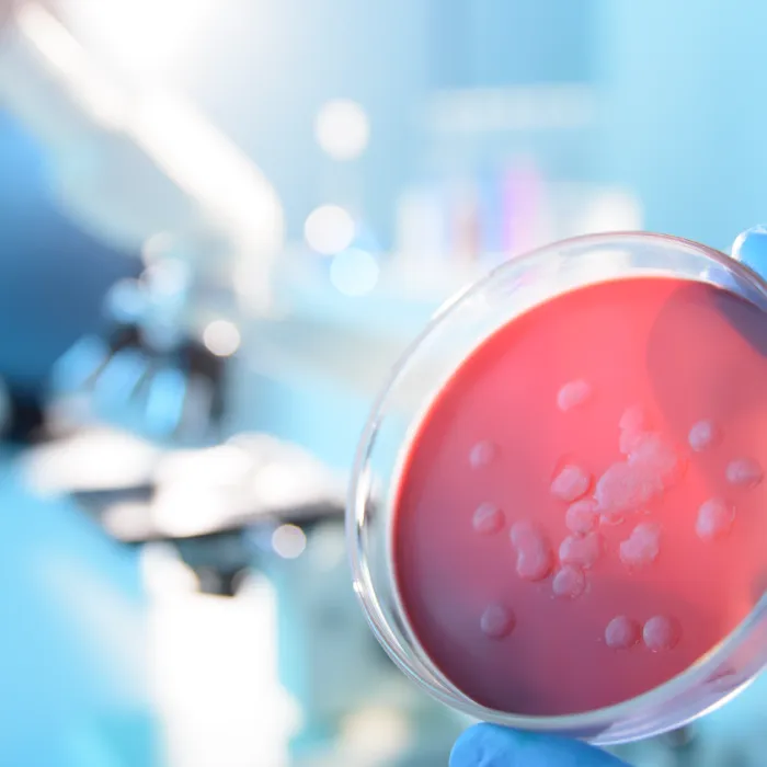 Red specimen in science petri dish. Exponent conducts rigorous epidemiological research to evaluate emerging diseases.