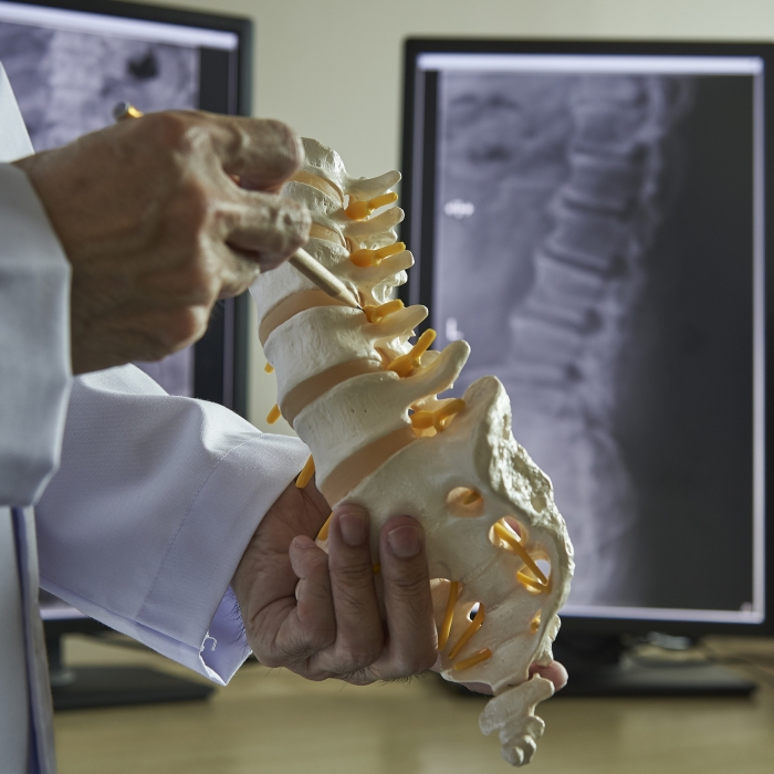 A neurosurgeon using pencil pointing at lumbar vertebra model in medical office. Lumbar spine x-ray on computer screen on background.
