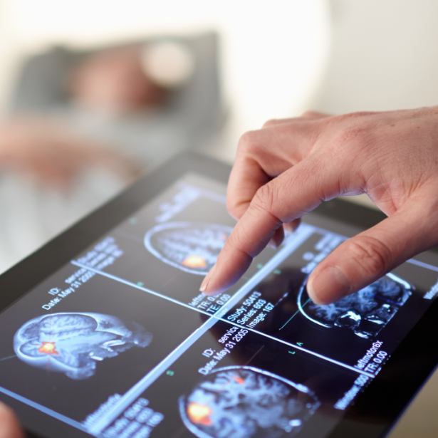 Tablet being held by a doctor showing images of brain scans
