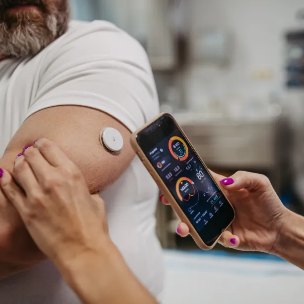 Doctor connecting patient's continuous glucose monitor with smartphone, to check his blood sugar level in real time. Obese, overweight man is at risk of developing type 2 diabetes. Concept of health risks of overwight and obesity.