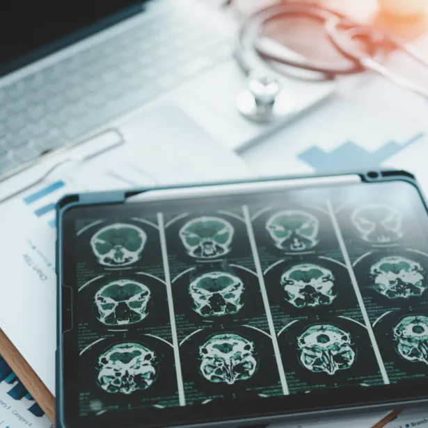 Cranial X-rays on a medical tray. Exponent examines human performance issues and behaviors in accident causation.