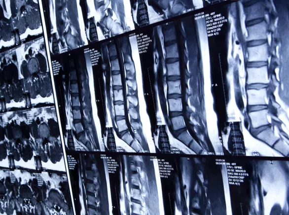 Spine