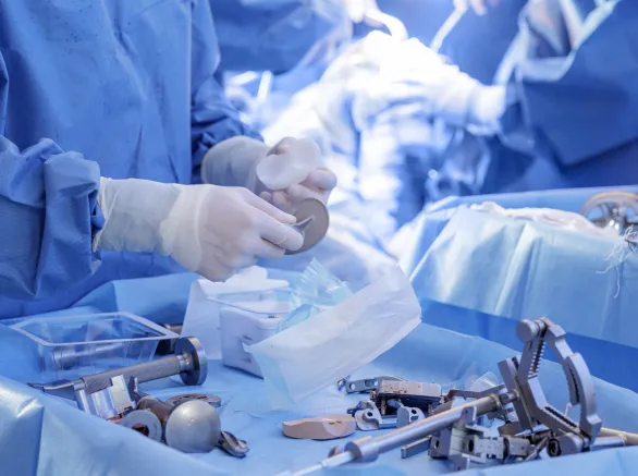 Surgeon prepares knee implant and tools on sterile blue drapes during total knee arthroplasty, showing modern OR workflow and equipment.