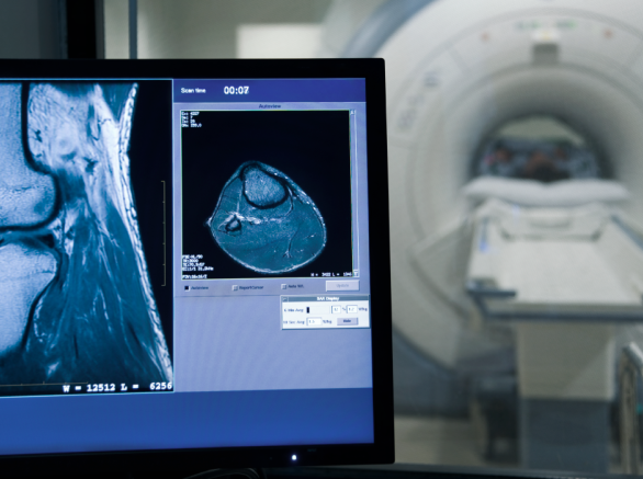 MRI Testing Compatibility
