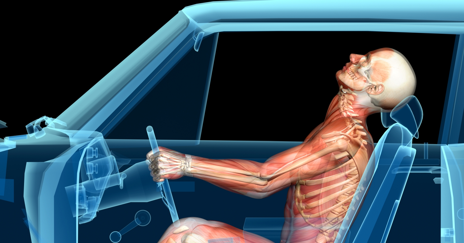 Muscular skeletal sketch of individual in car crash. Exponent biomechanical analysis of injury claims.