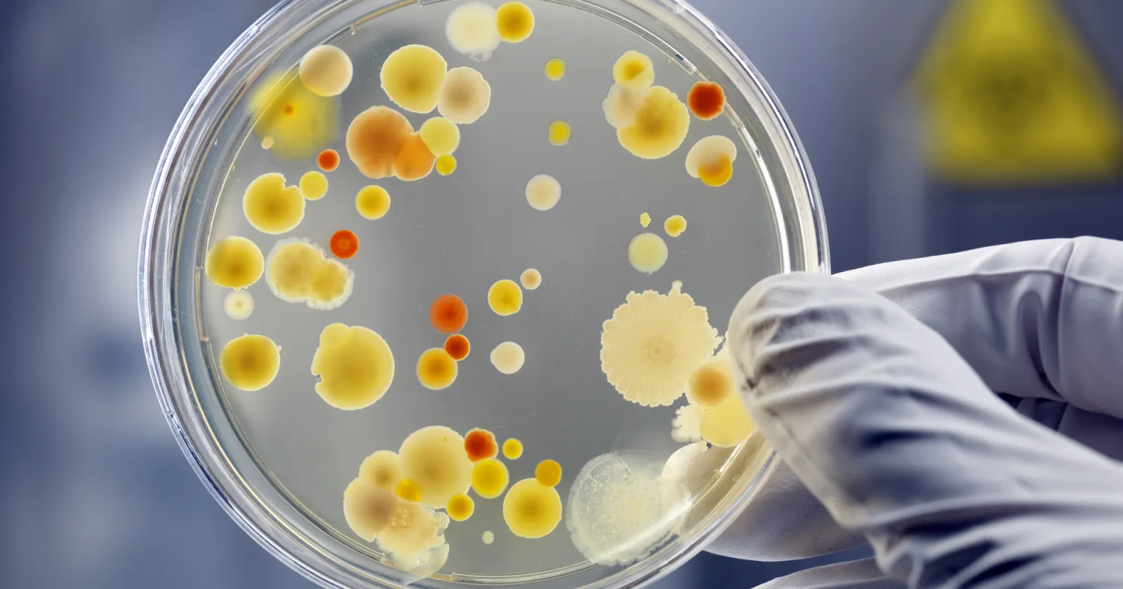 Clean culture of aerobic bacteria on agar plate, biohazard sign in background. Selective focus on petri dish, slightly blue toned, AdobeRGB color profile. Content of my lightbox medical &amp; sciences: