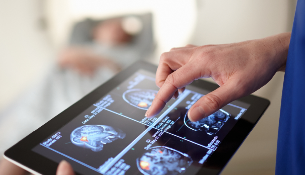 Tablet being held by a doctor showing images of brain scans