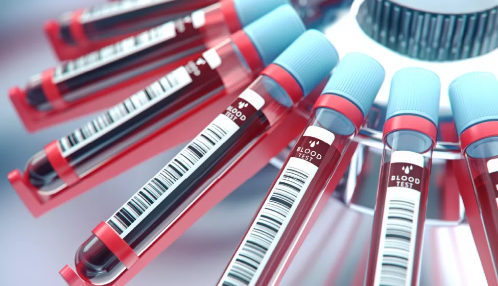Multiple vials of blood tests