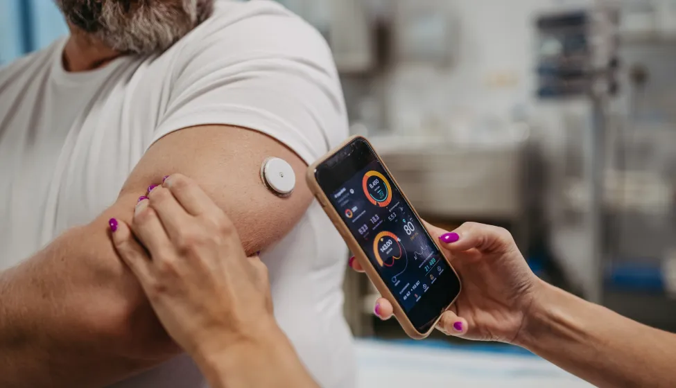 Doctor connecting patient's continuous glucose monitor with smartphone, to check his blood sugar level in real time. Obese, overweight man is at risk of developing type 2 diabetes. Concept of health risks of overwight and obesity.